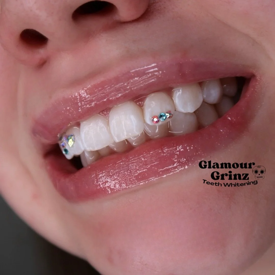 PERIOD 💎🦷✨
🔥🛜 Don&rsquo;t miss out on our Cyber Monday Event! 🛜🔥
ONLY ONE DAY - DEC. 1 

Booking Link in Bio
Claim your SPOT ✅🗓️

#glamourgrinz #greenbaytoothgems #teethwhitening #greenbaybeauty #greenbaywi #cosmeticteethwhitening #booknow #cy