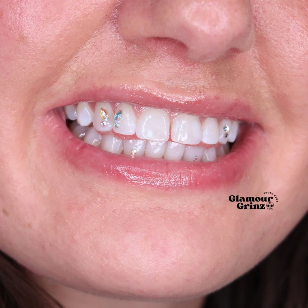 This is your reminder that you don&rsquo;t need a reason to glow ✨

Tooth gems are the easiest way to elevate your smile &mdash; subtle but noticeable 🦋💎

Spots open for March 🍀
Click "Book now" to reserve!

.
.

#glamourgrinz #greenbay 