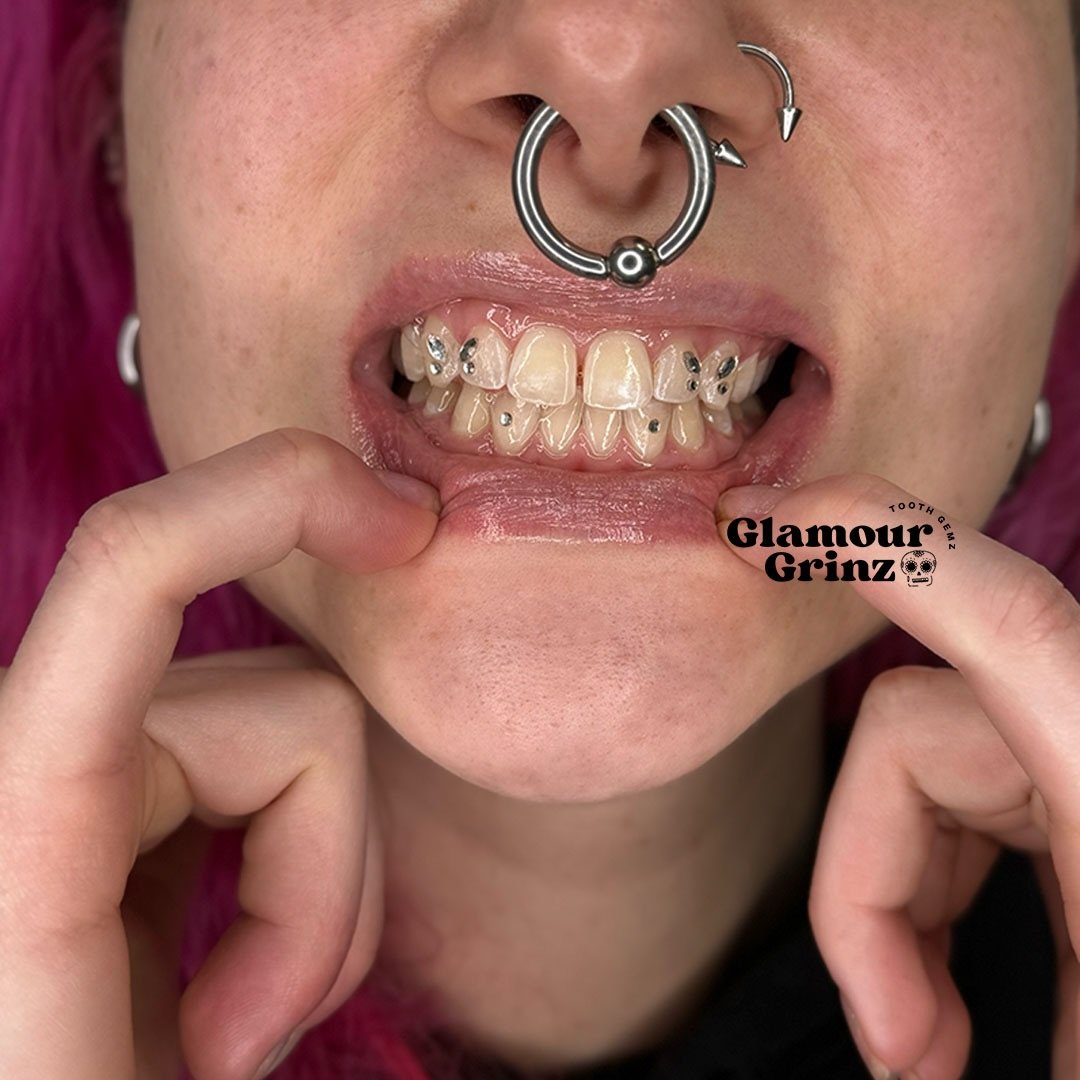 smiles don&rsquo;t have to be basic 😮&zwj;🔥

April spots open - book now 🌷🌼✨

#toothgems #greenbay #wisconsin