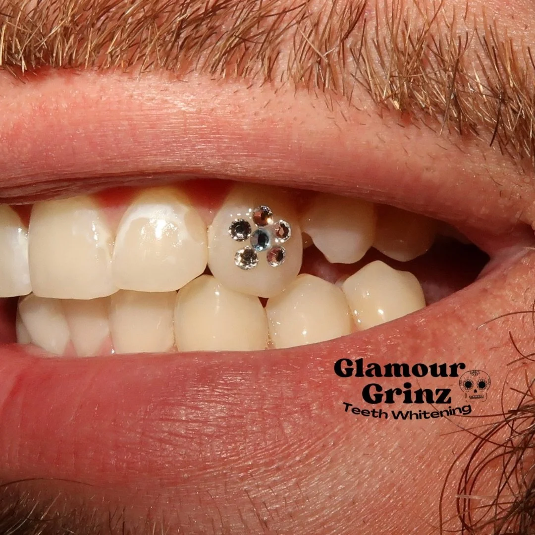 Let em know 😁💎

link in bio | book teeth whitening &amp; gems 🦷✨ 

#glamourgrinz #greenbay 
#teethwhitening #toothgems