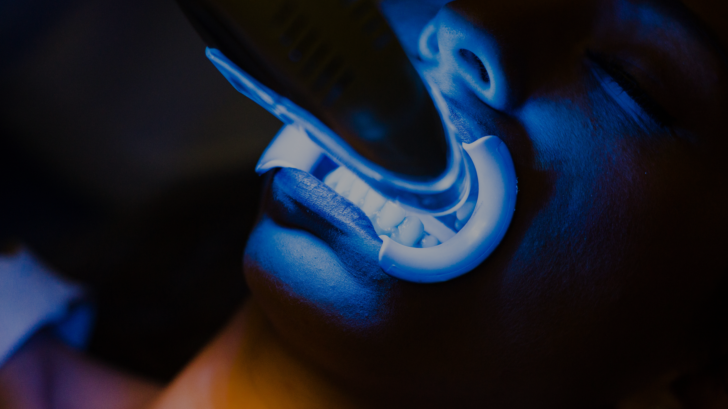 Close-up of a person with their mouth wide open, illuminated by blue light during a teeth whitening service at Bronze Couture in Kalamazoo, Michigan spray tanning and teeth whitening.