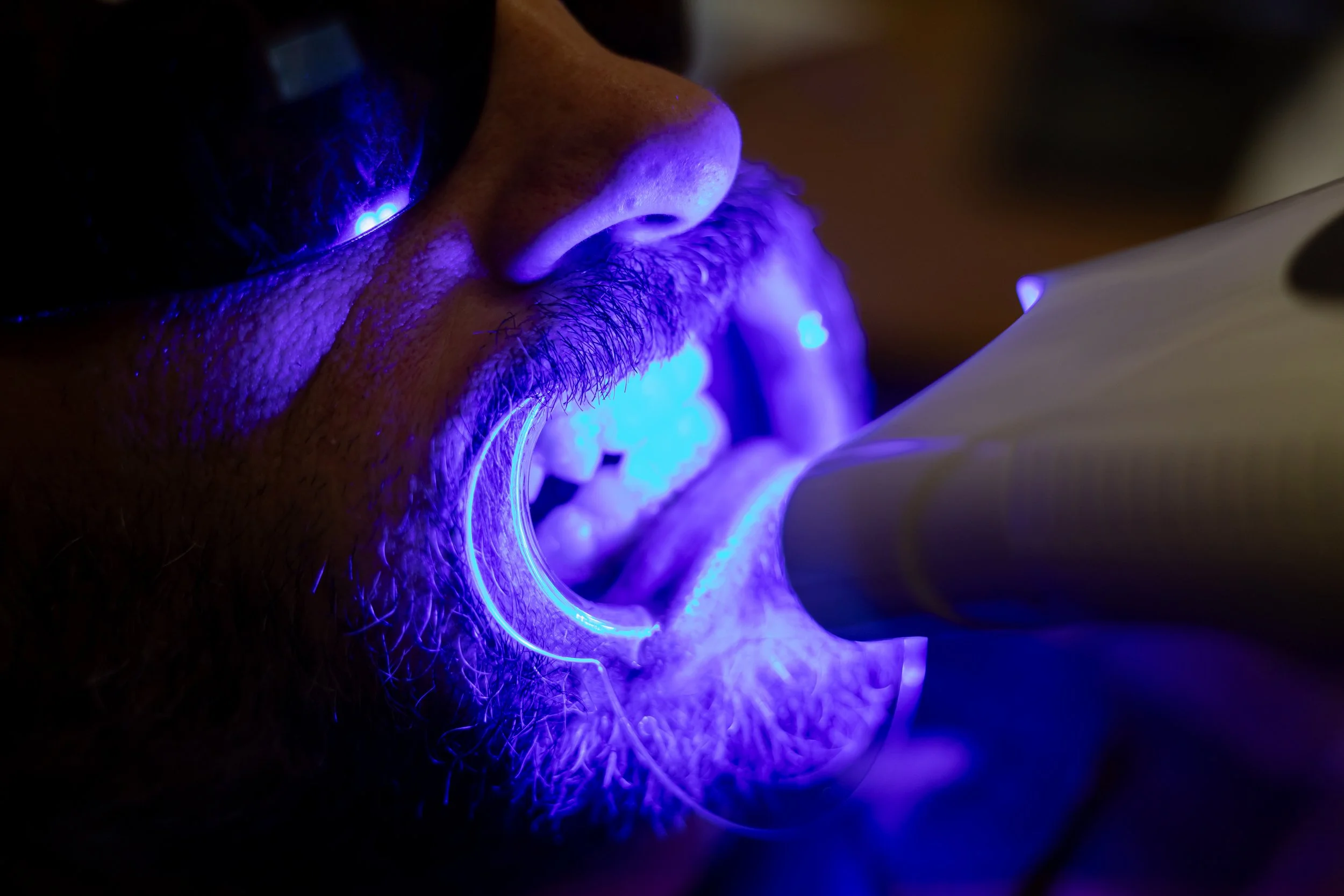 Close-up of a man with a beard using a blue light device for teeth whitening treatment at Bronze Couture in Kalamazoo, Michigan. Kalamazoo Spray Tanning and teeth whitening.
