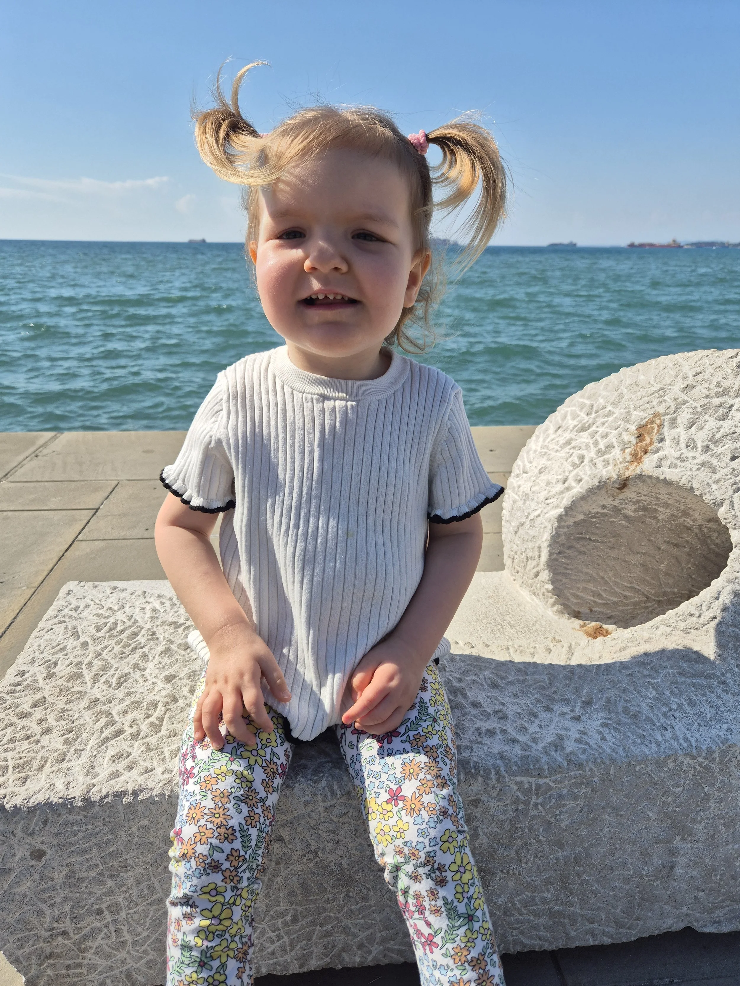 Young child affected by GAND genetic condition