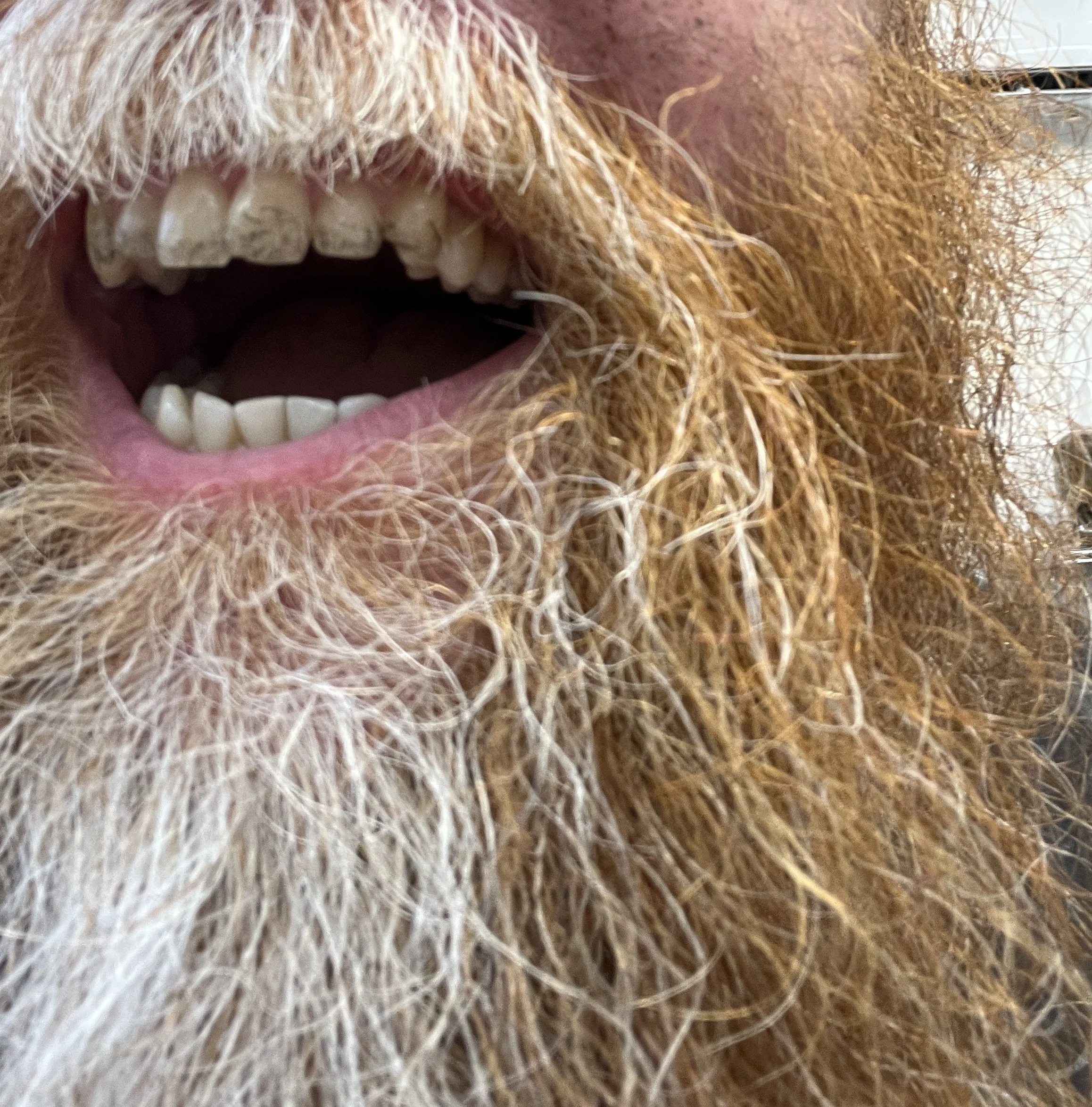 Even my teeth got in on it (and it tasted rank)