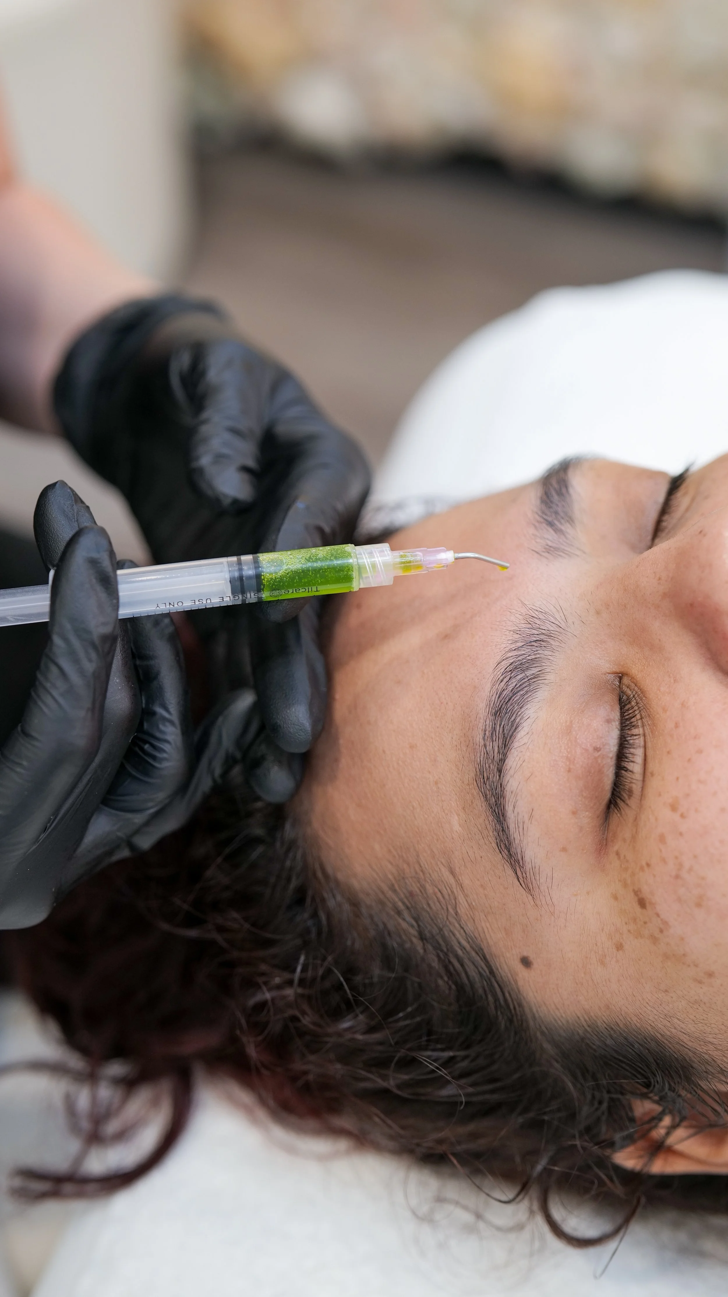 Chemical Peels for Beginners: What to Expect at Your First Peel