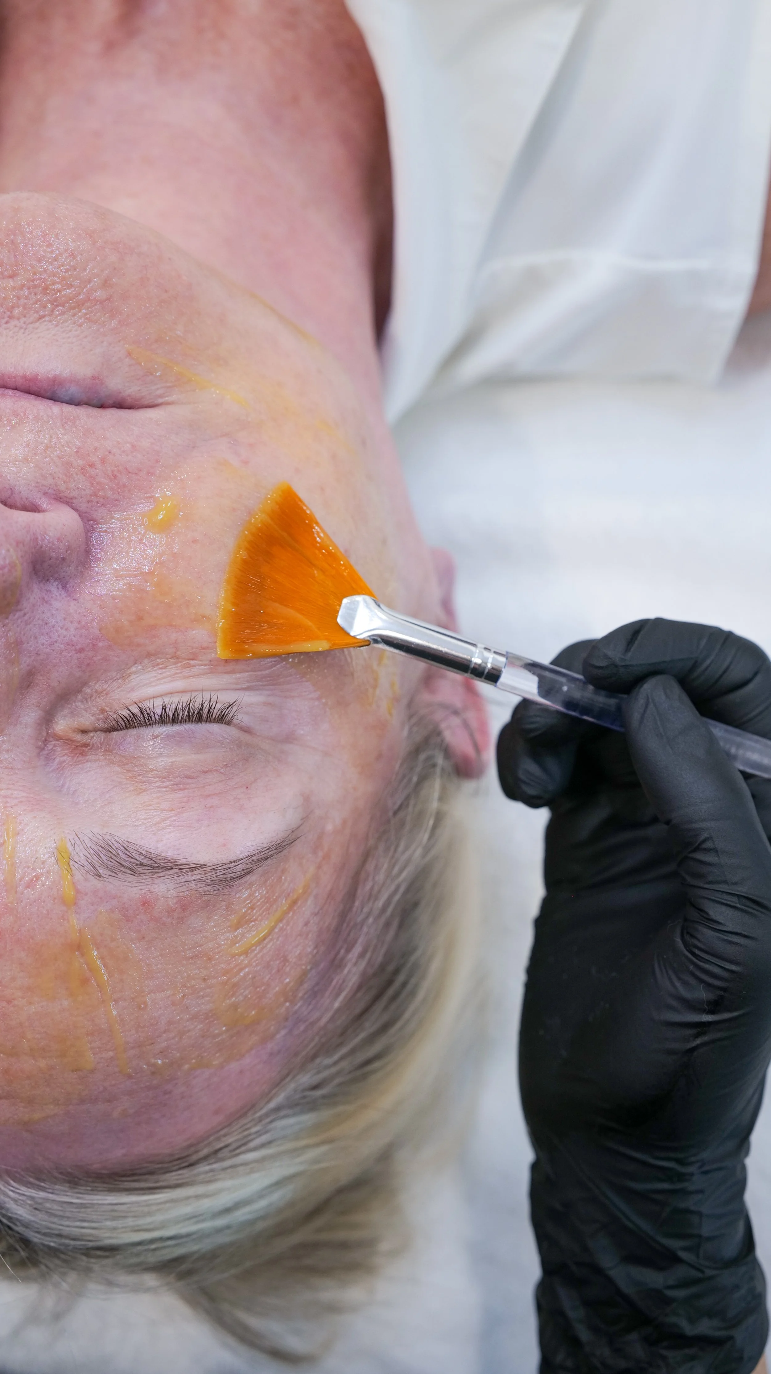 The Ultimate Guide to Sensitive vs. Sensitized Skin: Triggers, Mistakes, and Safe Treatments