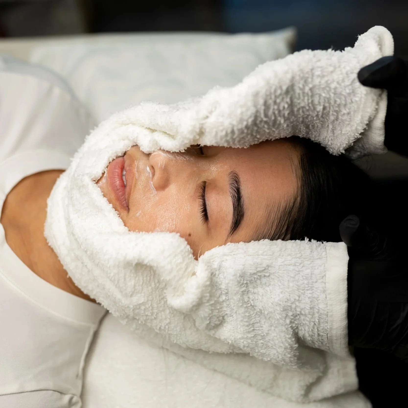 How Long Does a Chemical Peel Take to Heal? Your Recovery Timeline Explained by a Licensed Esthetician