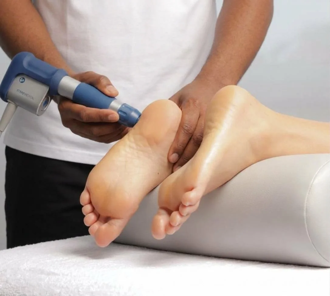 A person receiving a shockwave therapy for their chronic plantar fasciitis