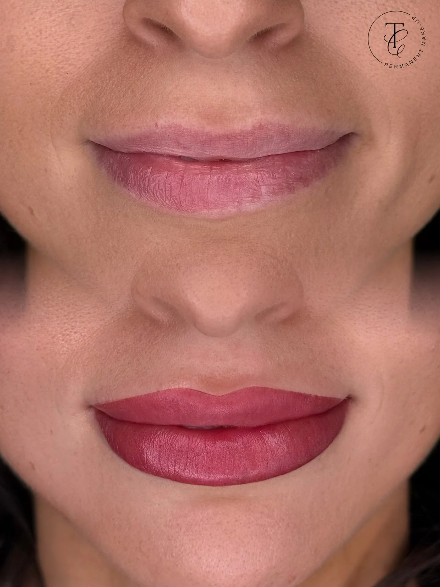 Proof that small changes make a big impact. 

This beautiful client was concerned about her lip symmetry, her vermillion border (especially on the bottom right) was very discoloured making one side of her lips look smaller and her cupids bow needed a