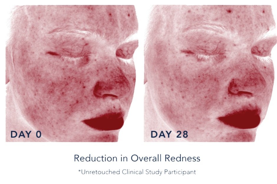 Prelude+Redness+Reduction.jpg