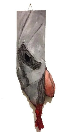 Laceration.jpg