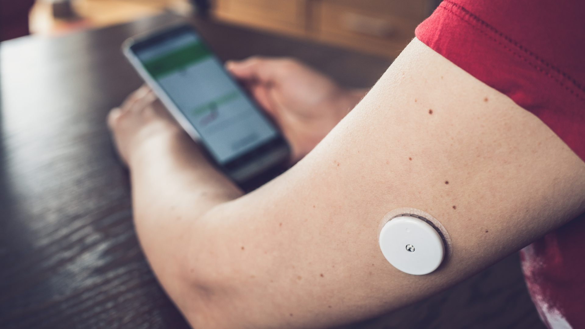 ¿Qué es un Monitor Continuo de Glucosa (CGM)?