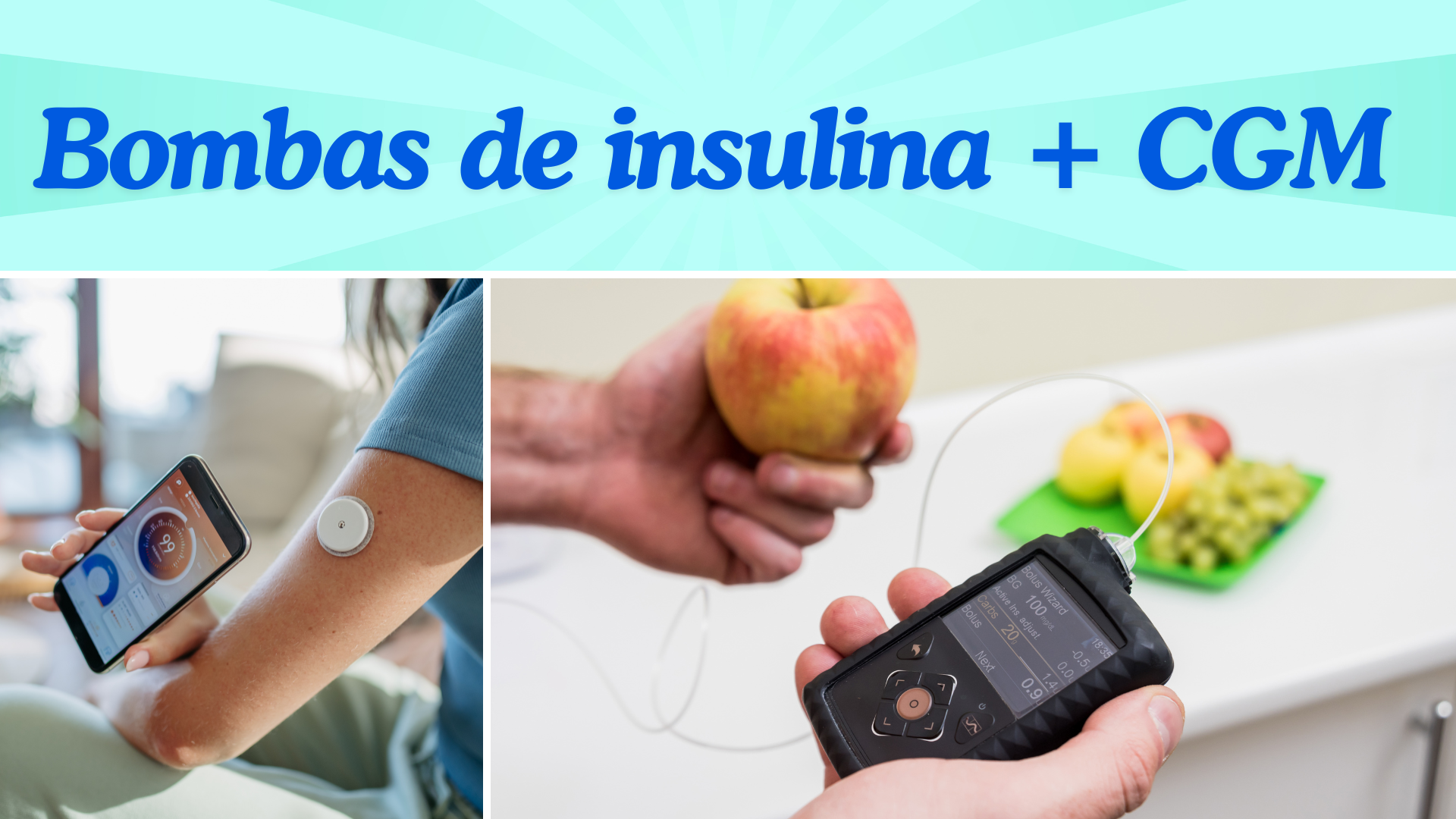 CGM + bomba de insulina: Un buen equipo para tu glucosa