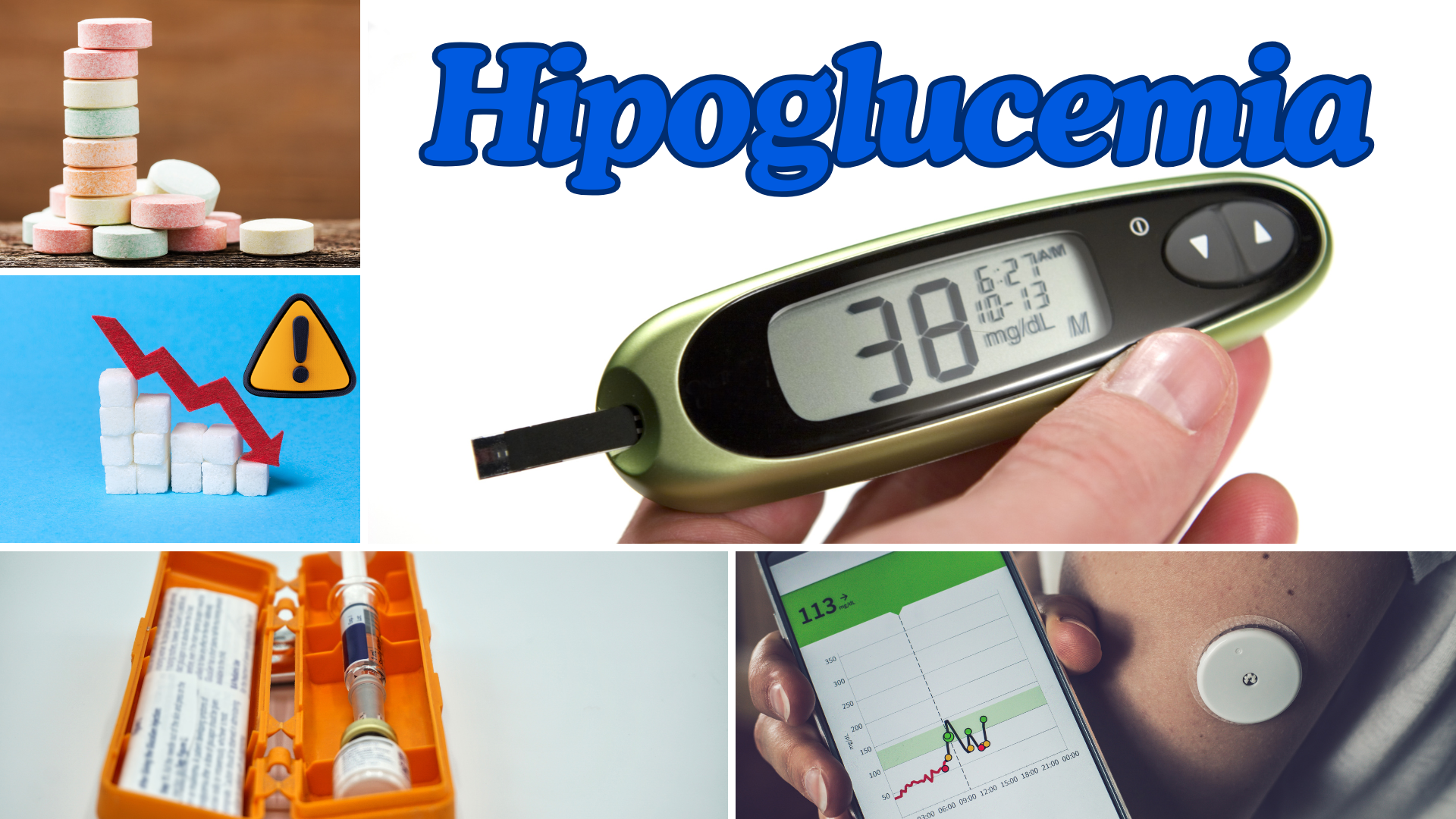 Hipoglucemia: ¿Qué es y cómo tratarla?