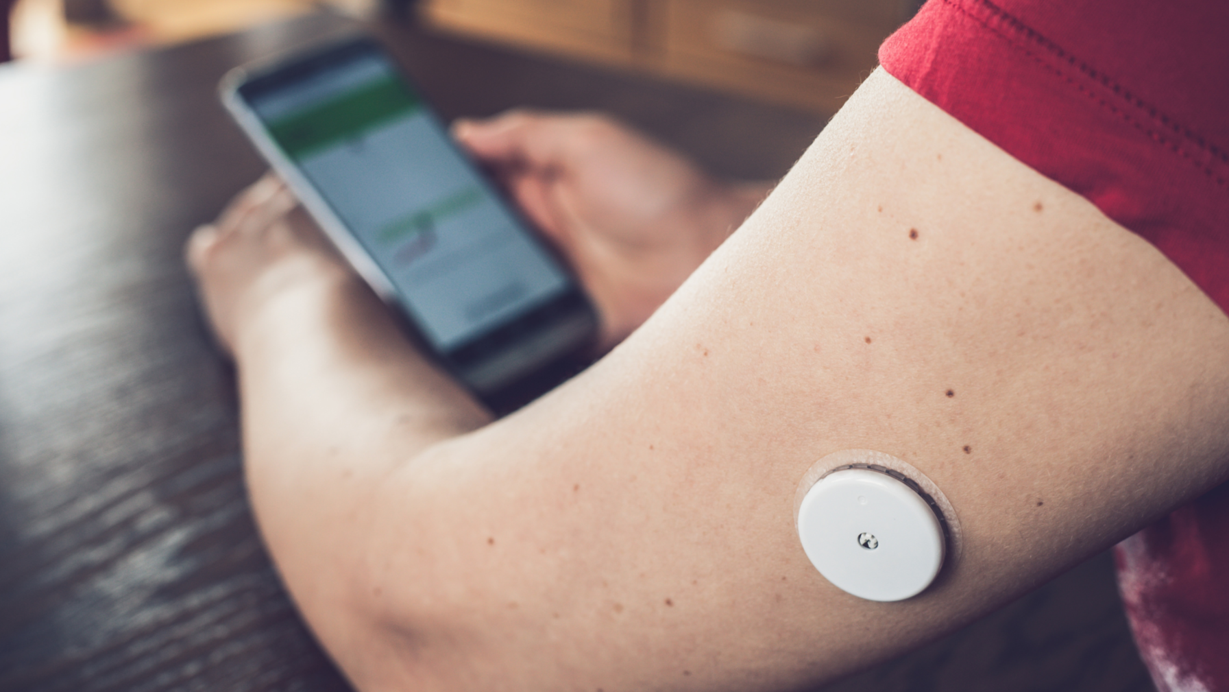 What Is a Continuous Glucose Monitor (CGM)?