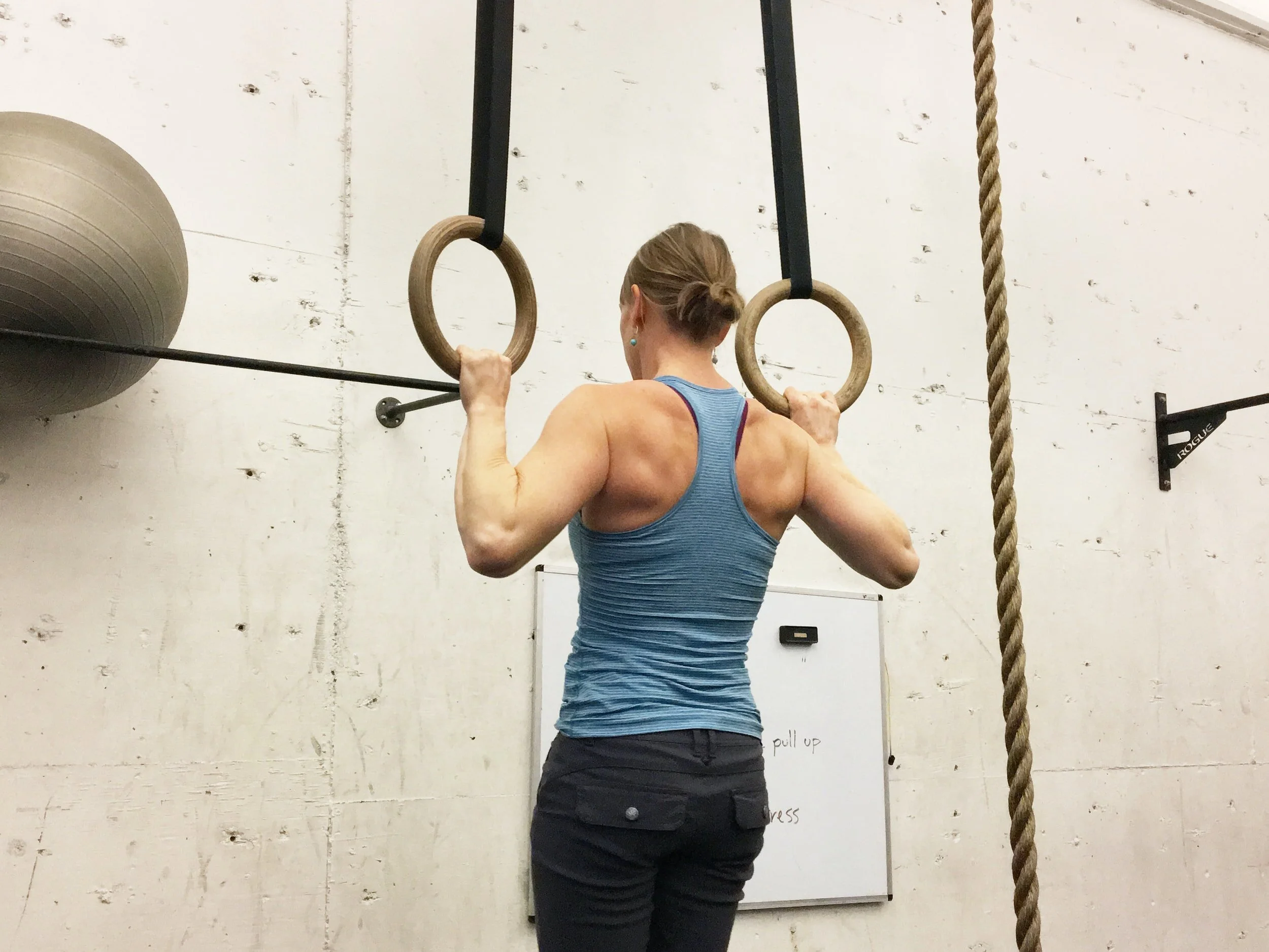 Shoulder Bursitis