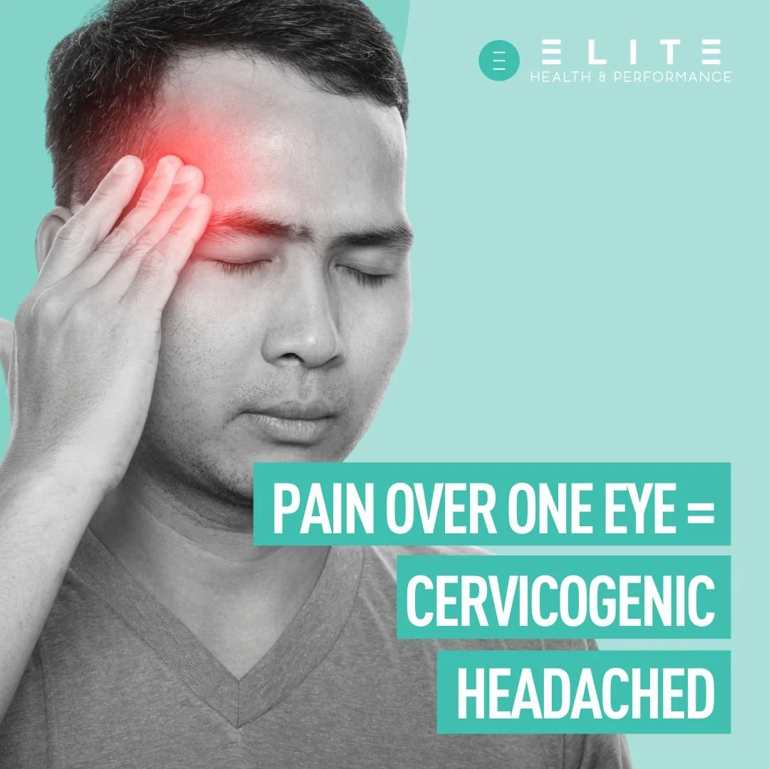 Headaches that start in the neck are a different beast altogether.

Not all headaches are migraine, tension, or stress related.
A large portion of recurring headaches we see are actually cervicogenic, meaning the pain is referred from the cervical sp