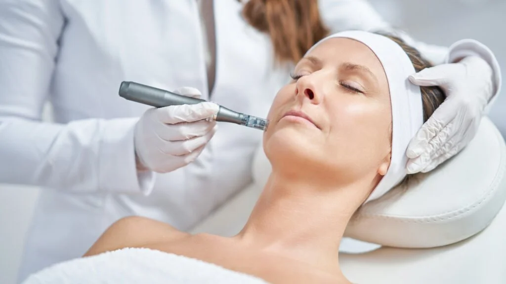 Microneedling_-1024x576.jpg