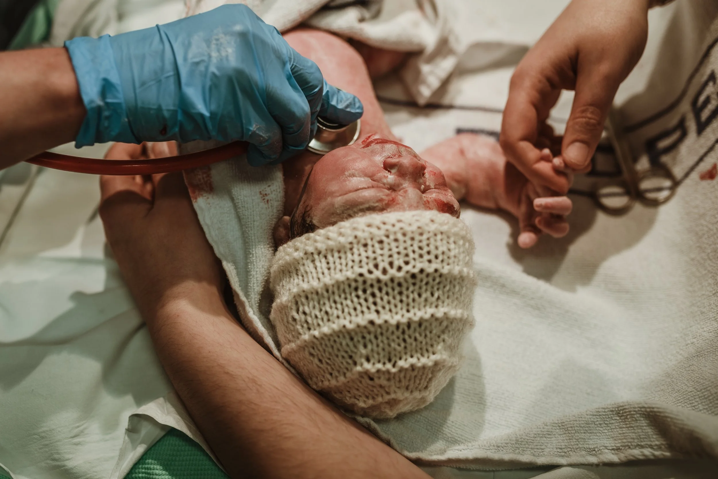 Medical team's gloved hands attending to newborn after delivery — hospital birth photography Glasgow, Marieke Captures Birth