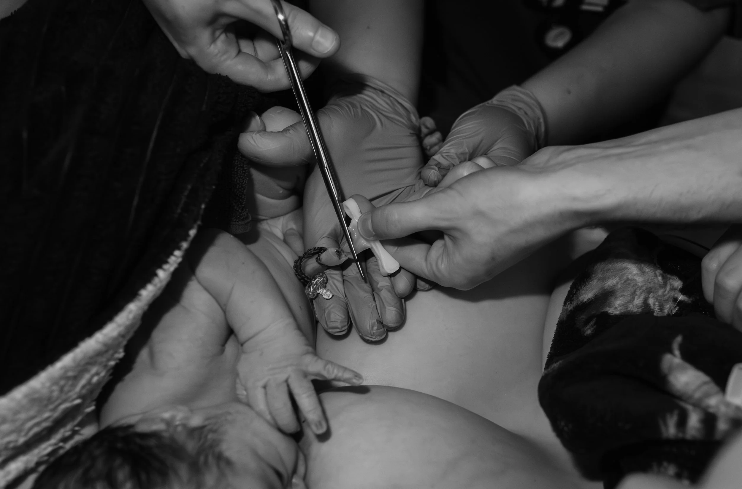 Black and white image of hands cutting the baby’s umbilical cord with scissors after a home birth