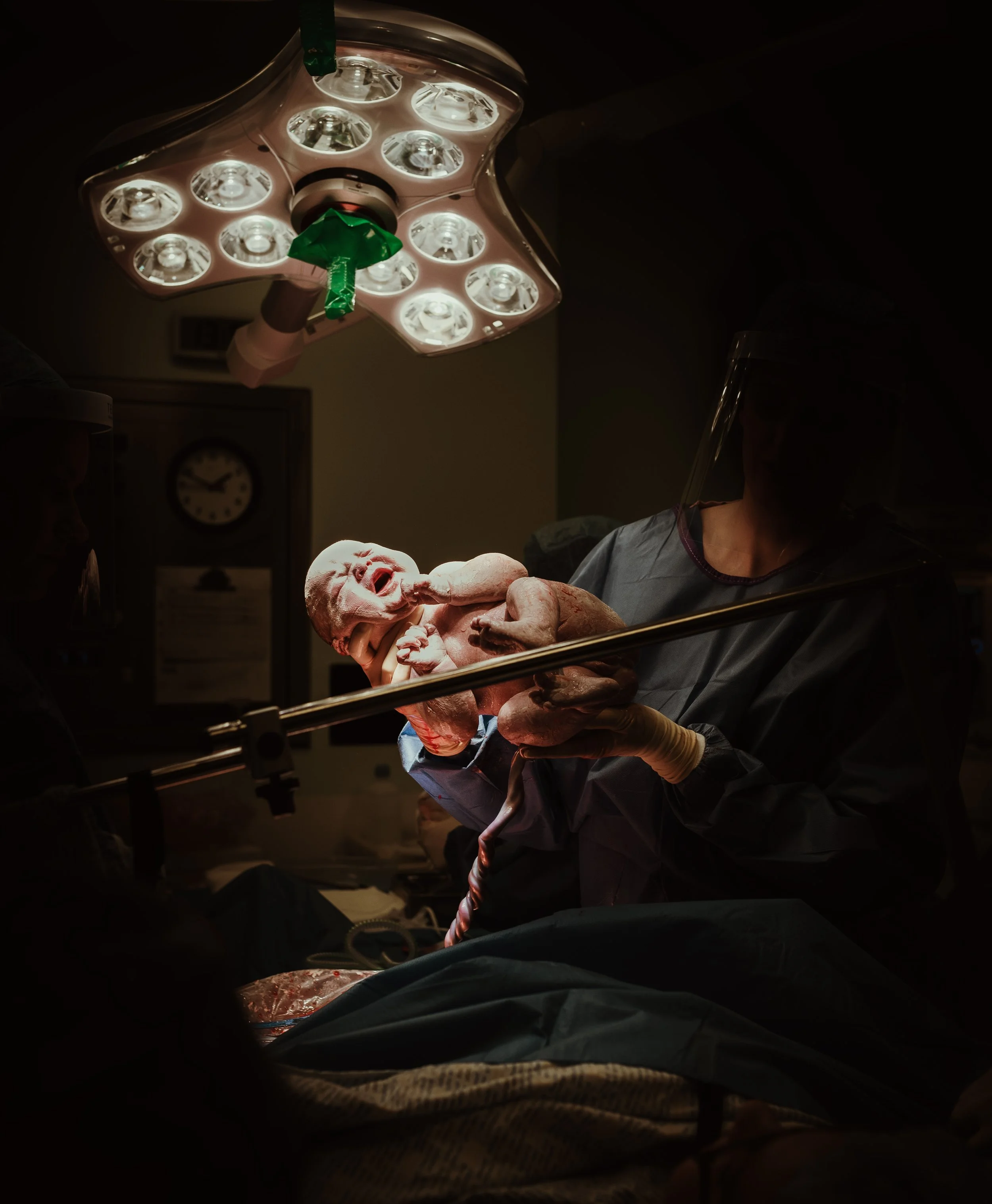 Newborn delivered under theatre lights during caesarean birth, Glasgow — elective caesarean birth photography by Marieke Captures Birth