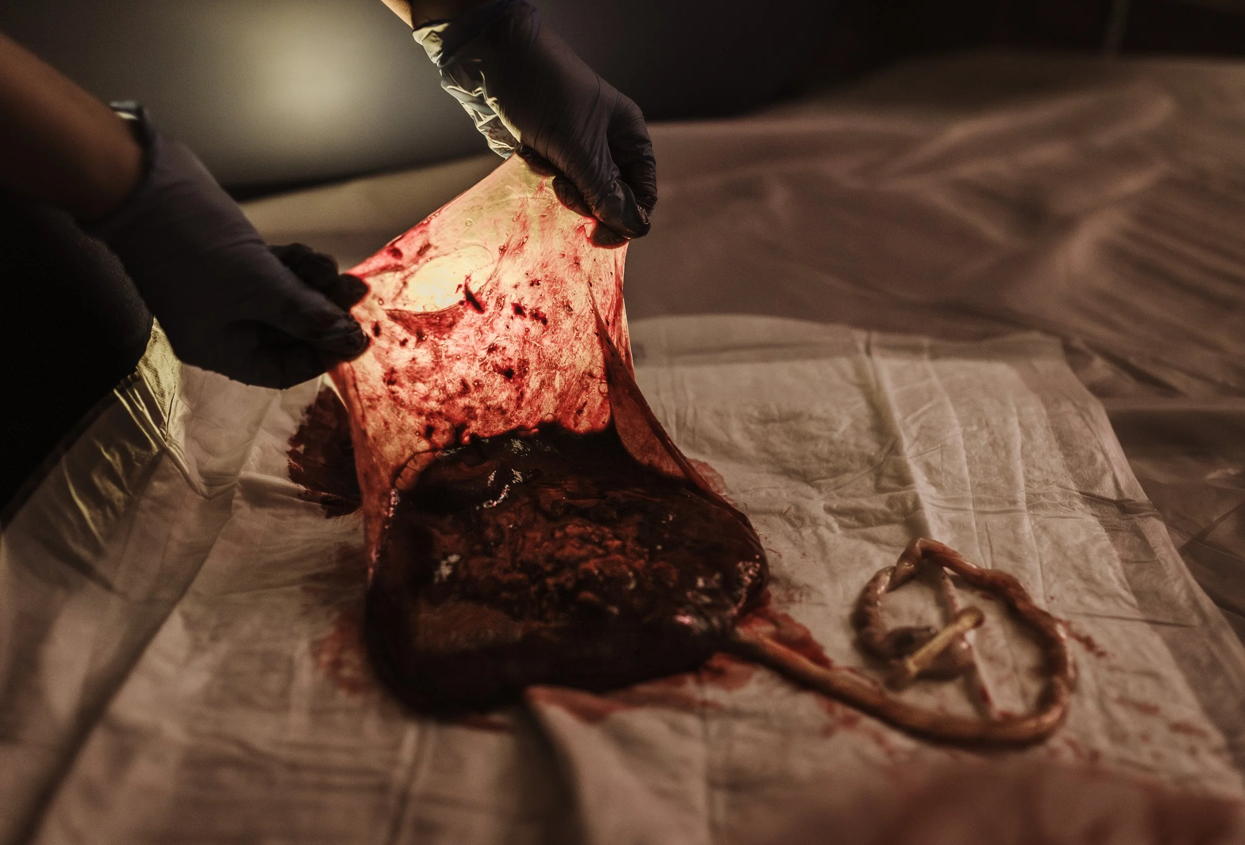 Midwife from the Ayrshire Homebirth Team holding up the intact membrane of the placenta after a home water birth in Largs Scotland