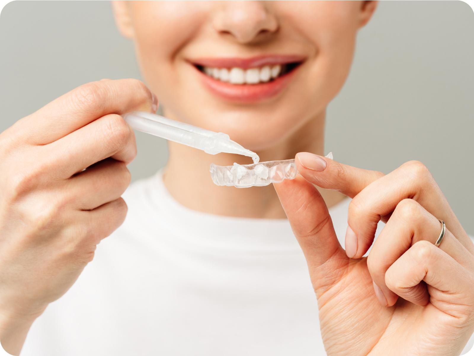 Teeth Whitening-3.png