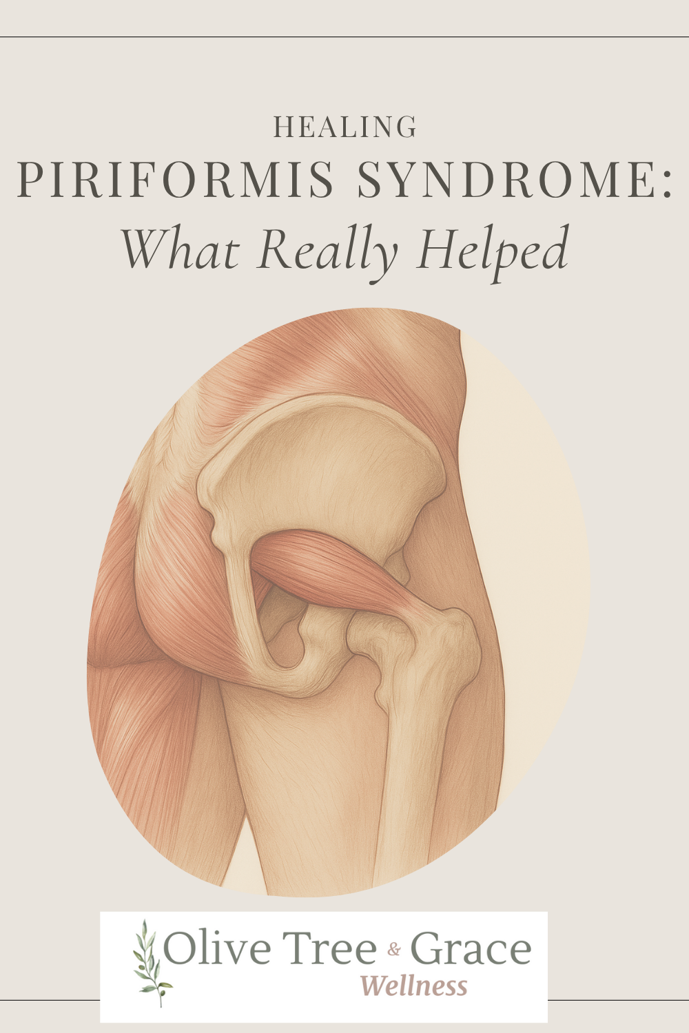 Healing Piriformis Syndrome: What Really Helped