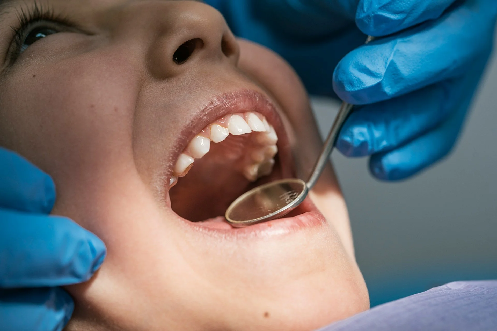 wisdom teeth or baby teeth for stem cells