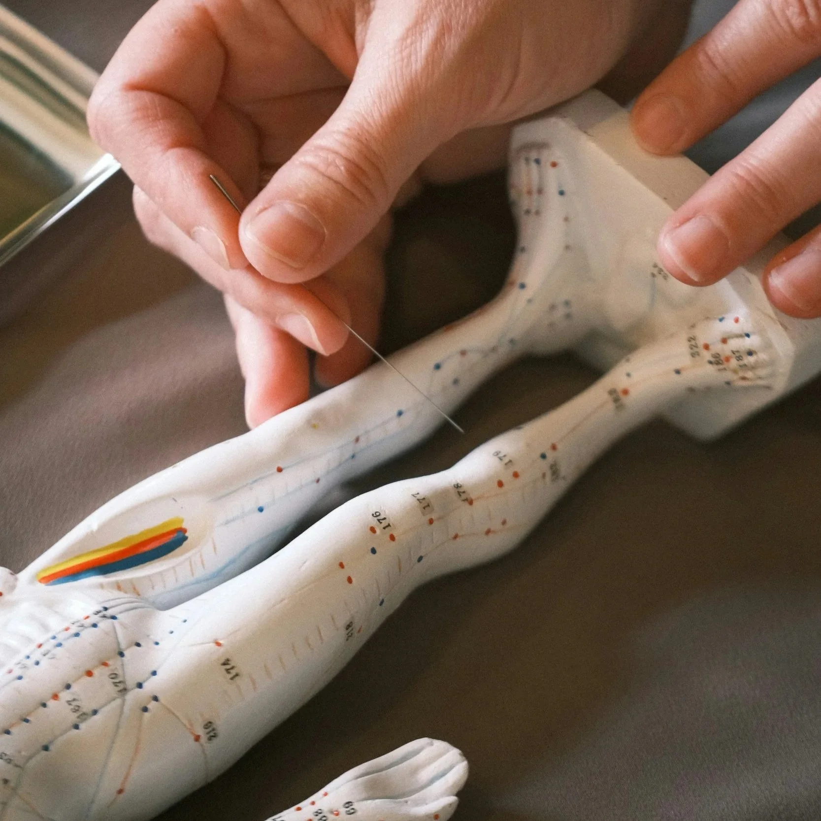 Dry Needling Mount Pleasant SC
