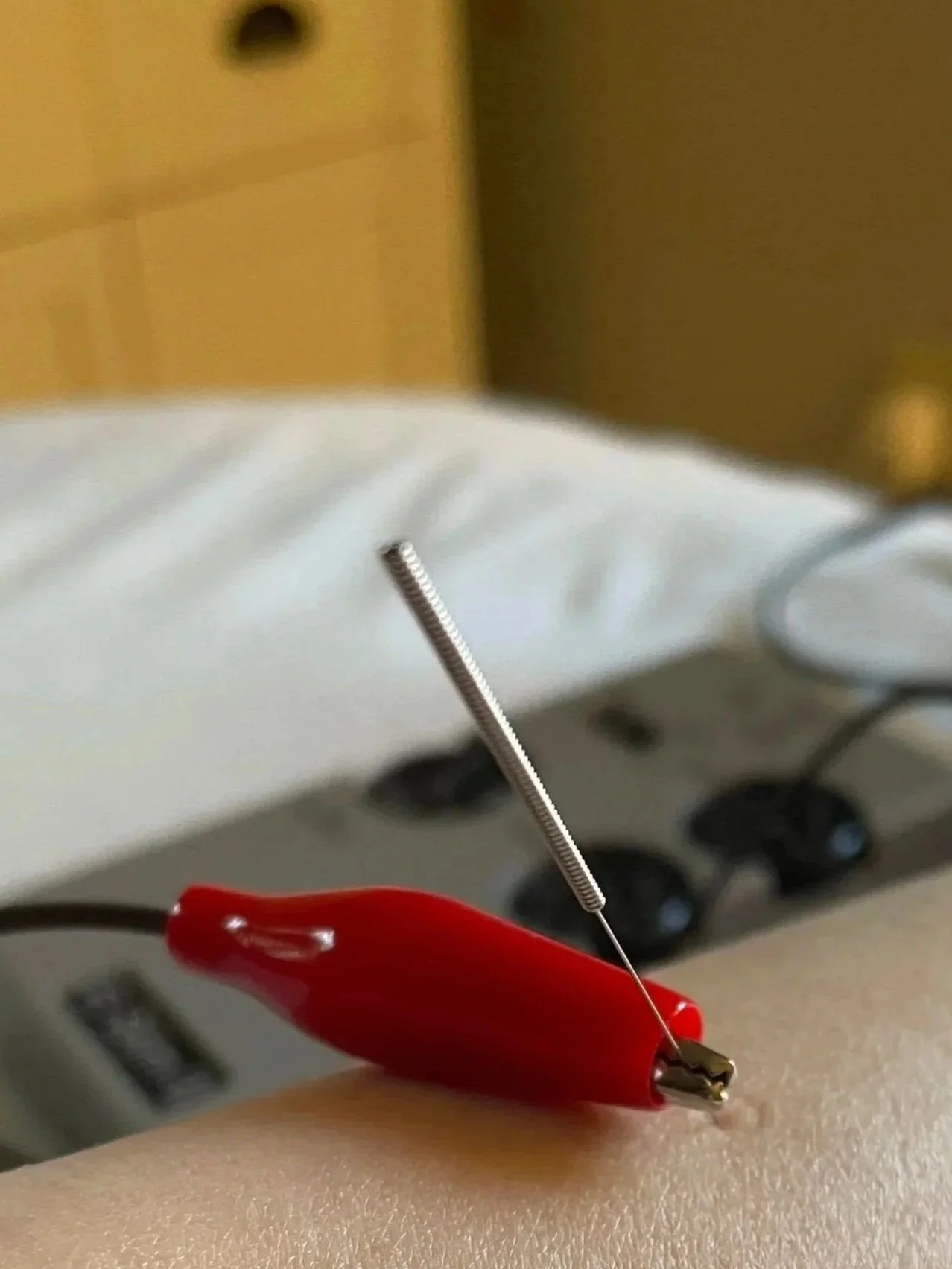 Natural Pain relief with acupuncture in Charleston SC