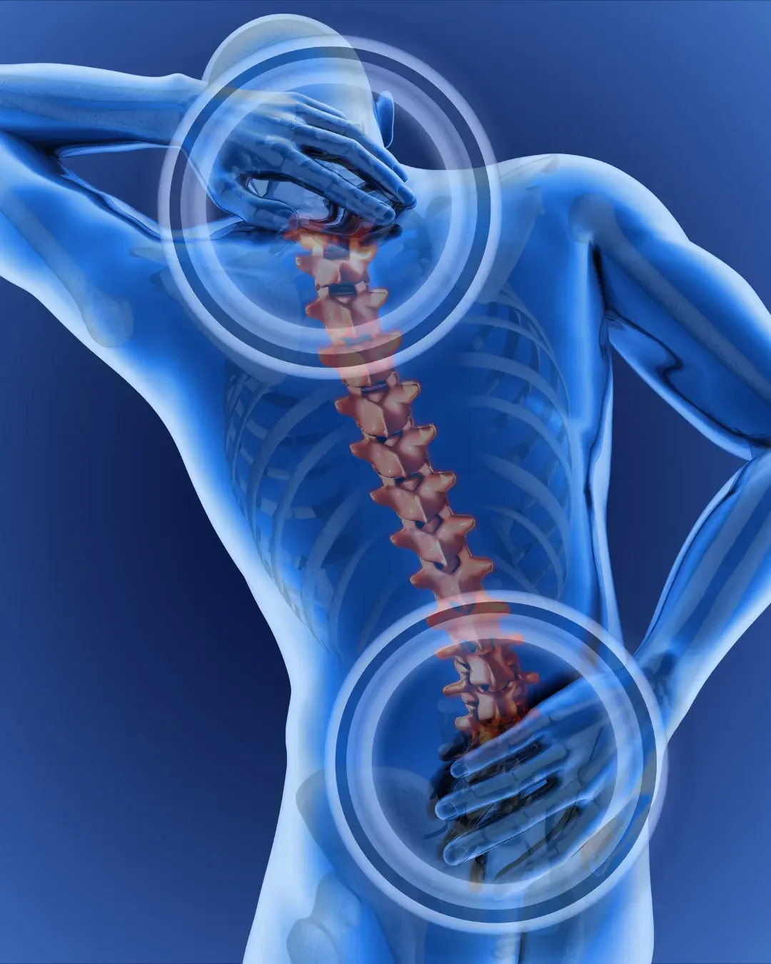 Chiropractic for neck and back pain