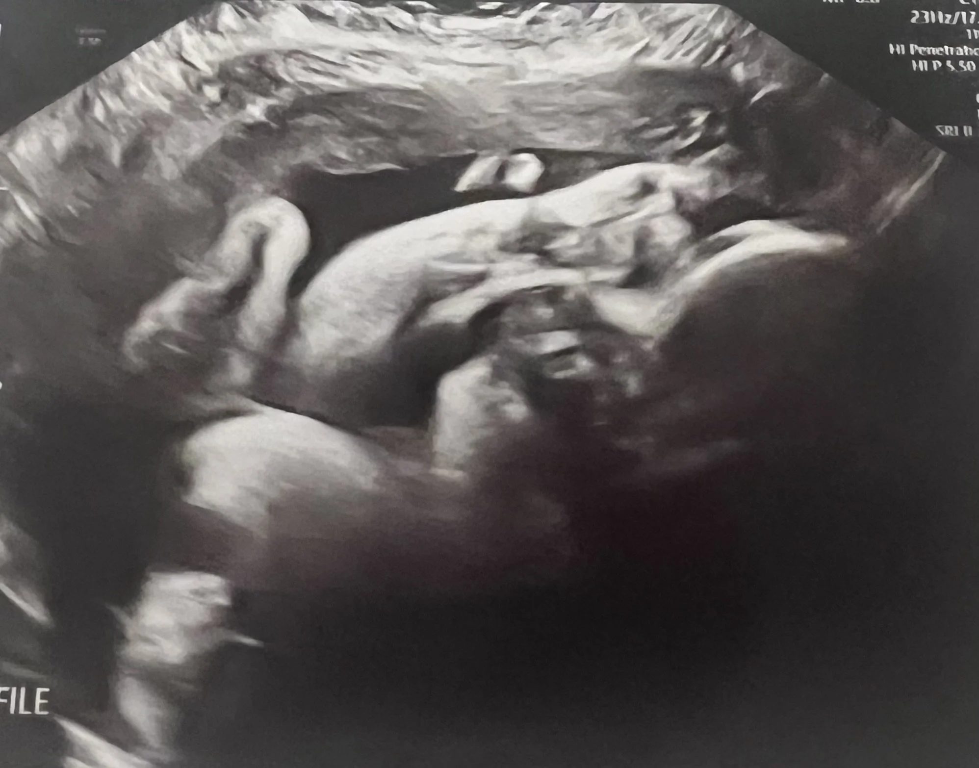 10 Money Moves to Make Before Your Baby Arrives