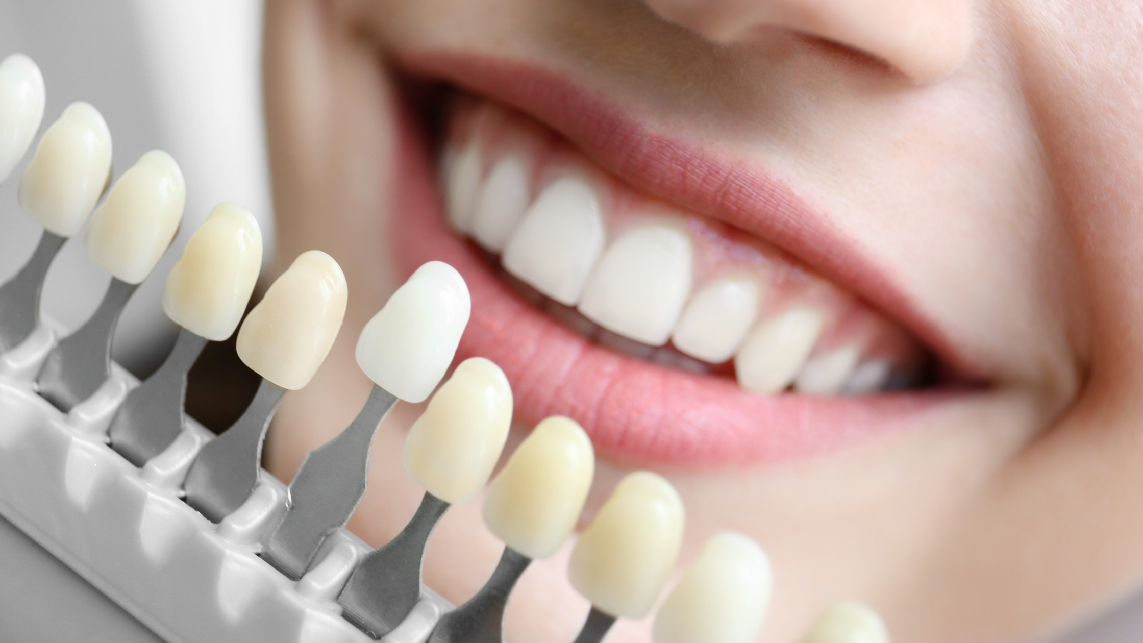 teeth-whitening-nambour