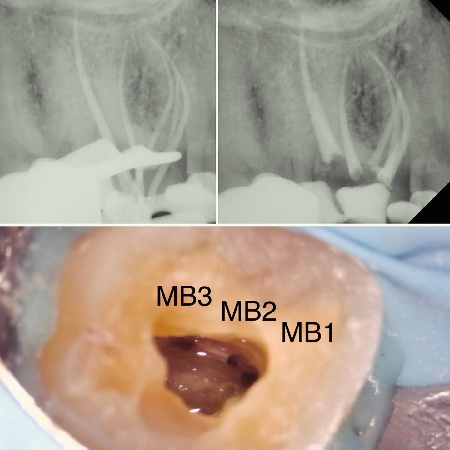 Uno, dos, tres 👌🏼👌🏼👌🏼