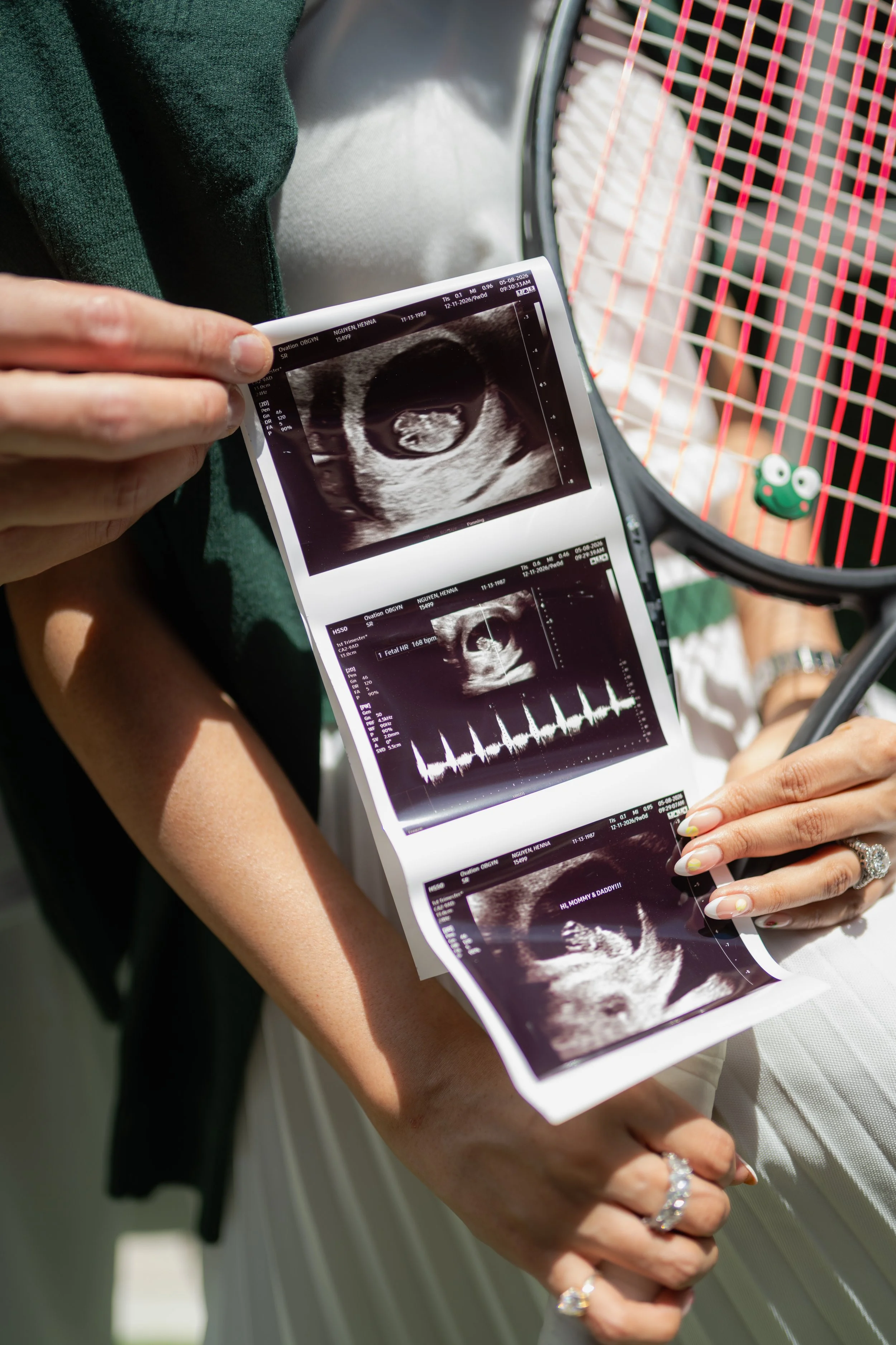 A pregnant woman holding ultrasound photos showing her baby, with her partner's arm around her. In the background, a tennis racket and a small frog toy are visible.