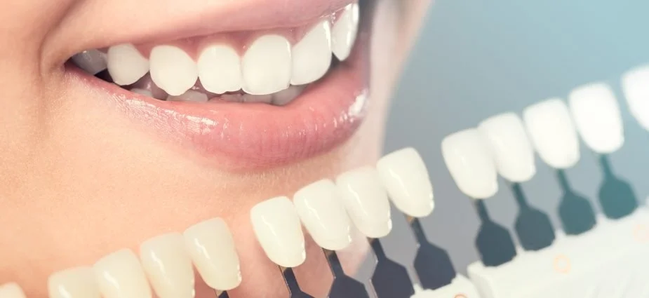 Cosmetic Dentistry Services