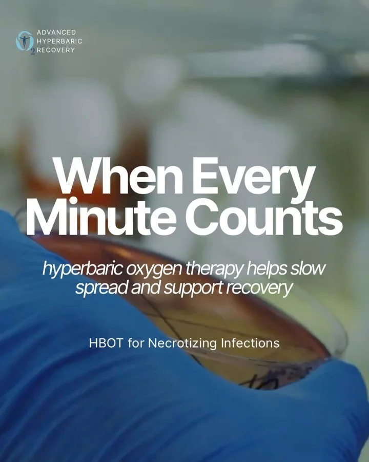 Necrotizing infections demand rapid, aggressive intervention-but timing matters 🦠

Emerging evidence suggests that early administration of HBOT can accelerate infection control and support better clinical outcomes when used alongside surgery and ant