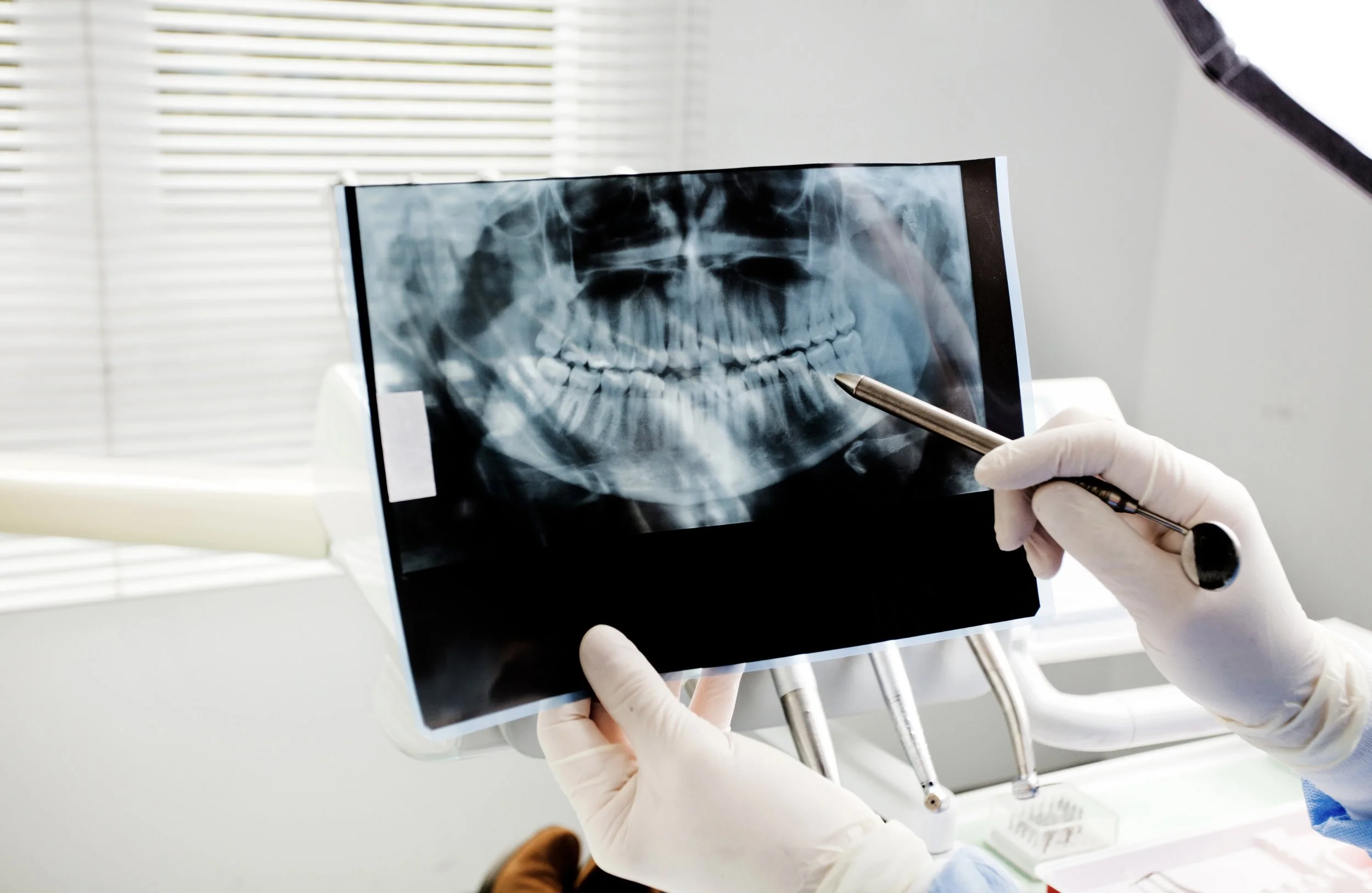 An Exciting Look: HBOT Applications for Dental Patients