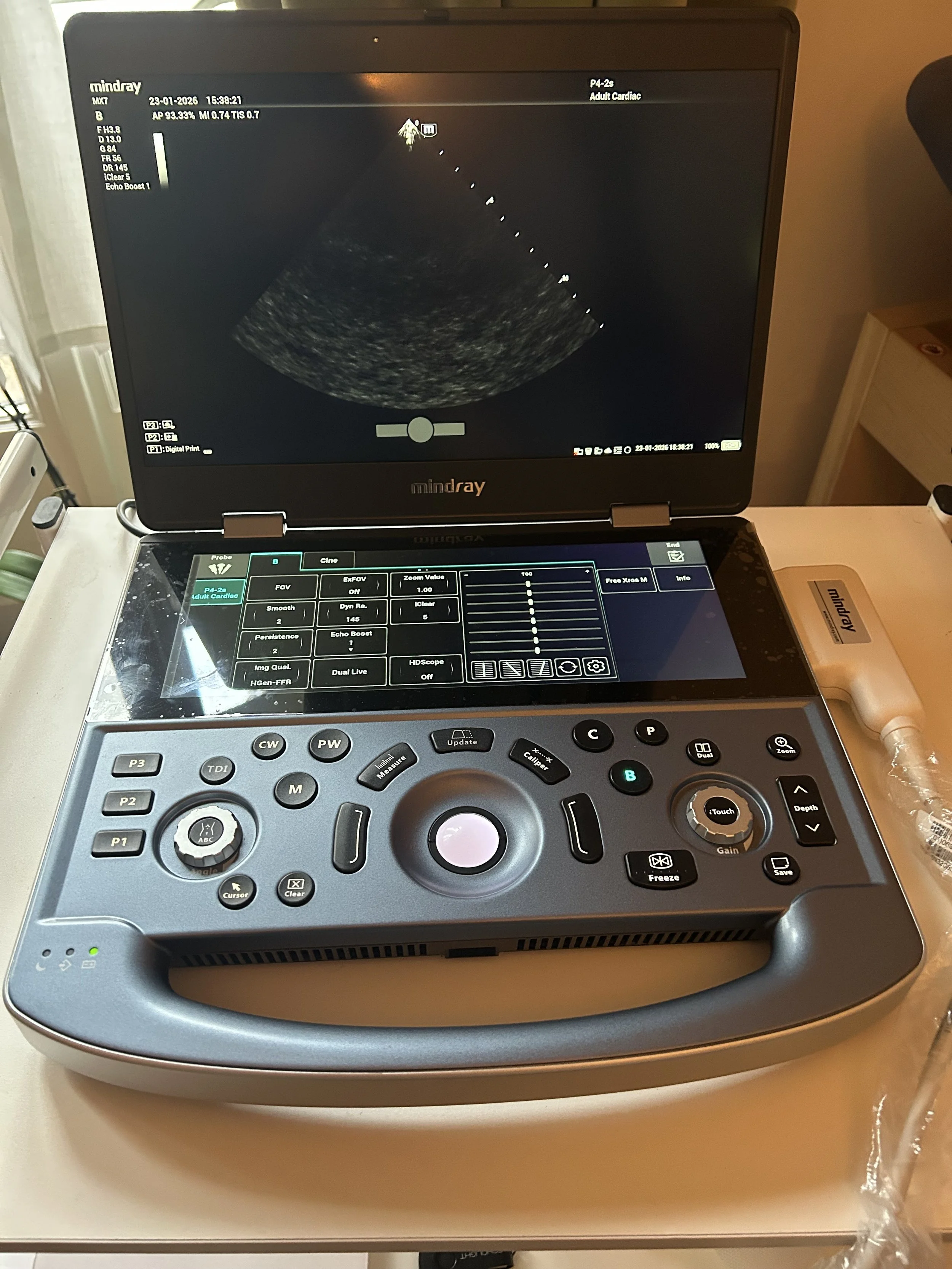 Ecografia addominale e ecocolor Doppler vasi venosi e arteriosi vascolare