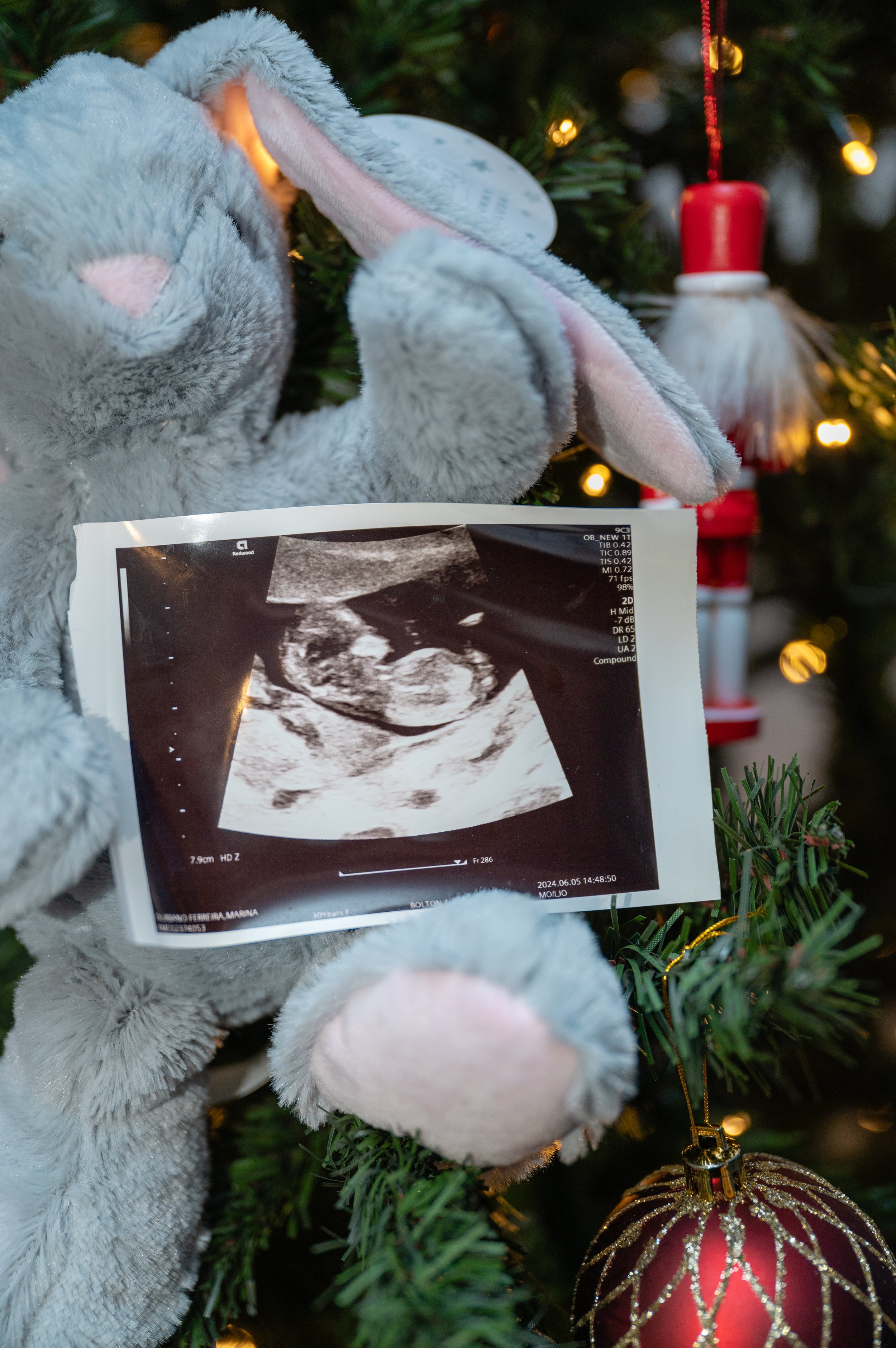 Ultrasound photo clipped to a plush rabbit on a decorated Christmas tree.