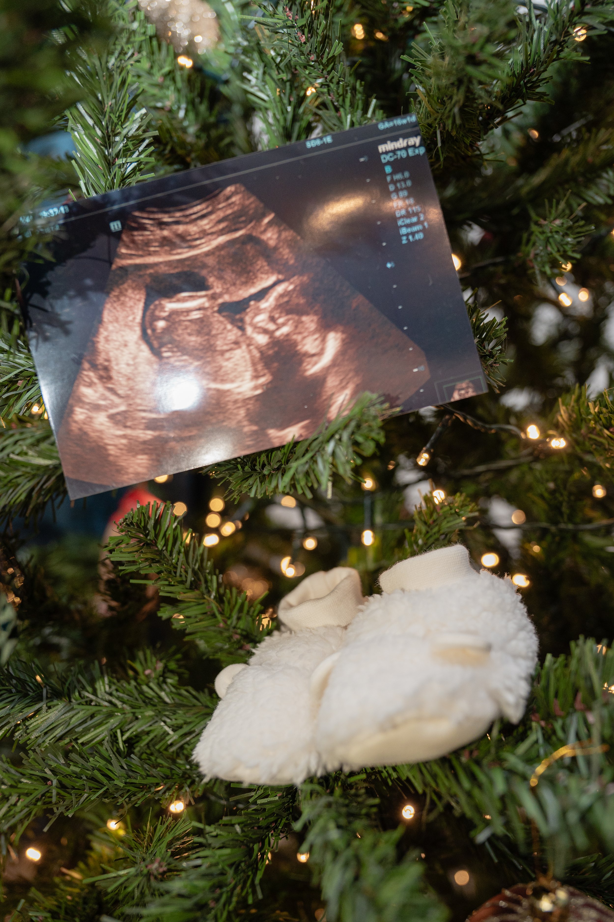 Ultrasound photo and baby booties on a decorated Christmas tree.