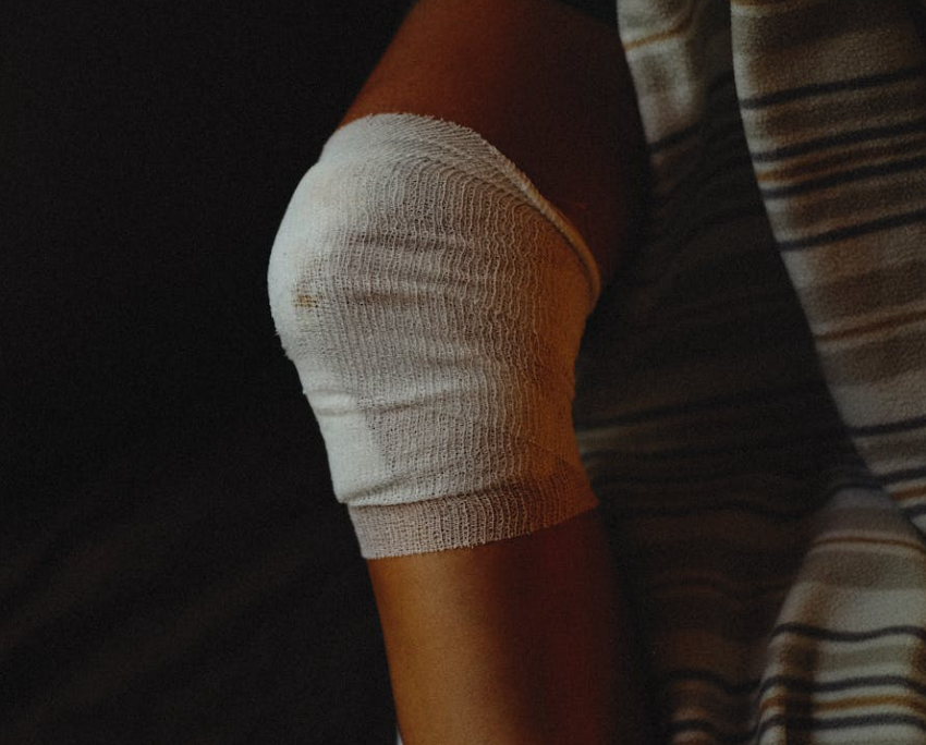 Red Light Therapy for Lymphedema