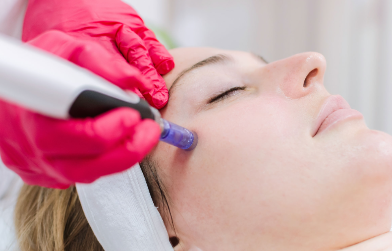 Red Light Therapy After Microneedling