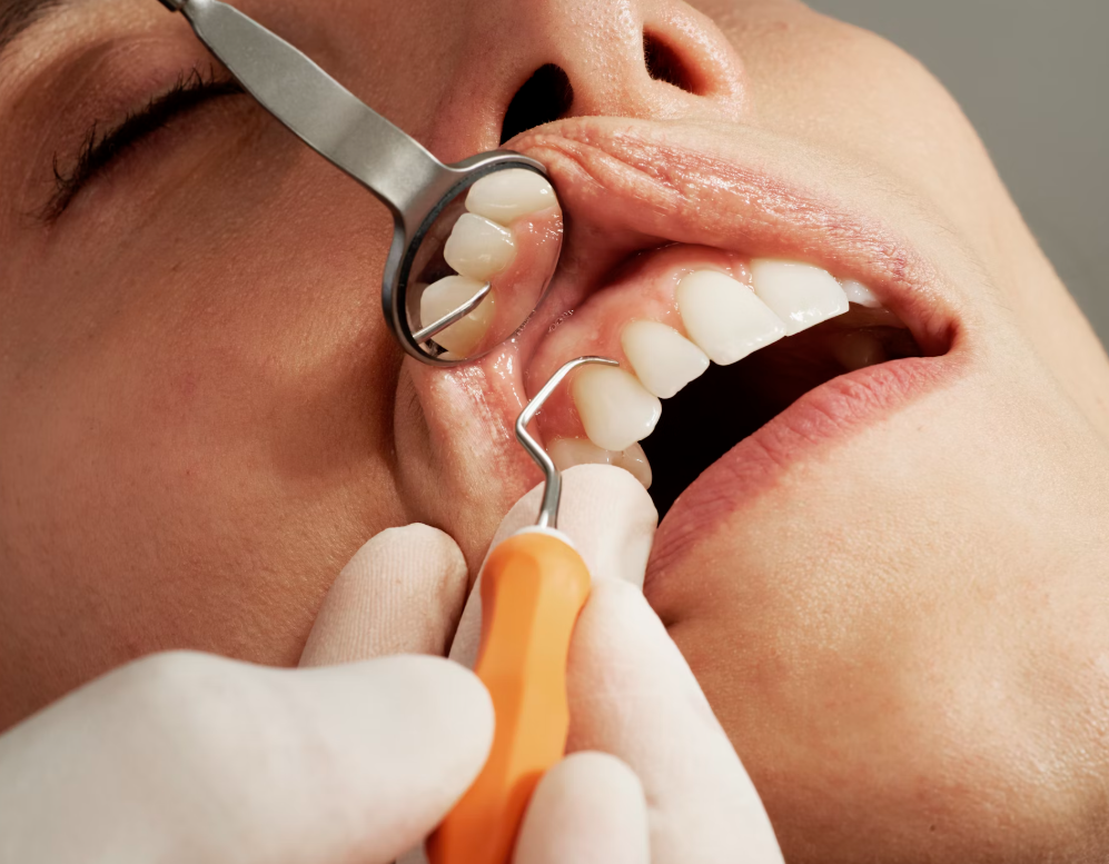 Red Light Therapy for Dental Plant Stability
