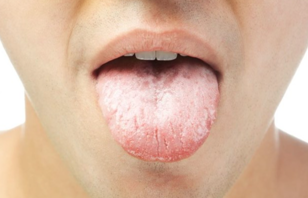 Red Light Therapy for Dry Mouth