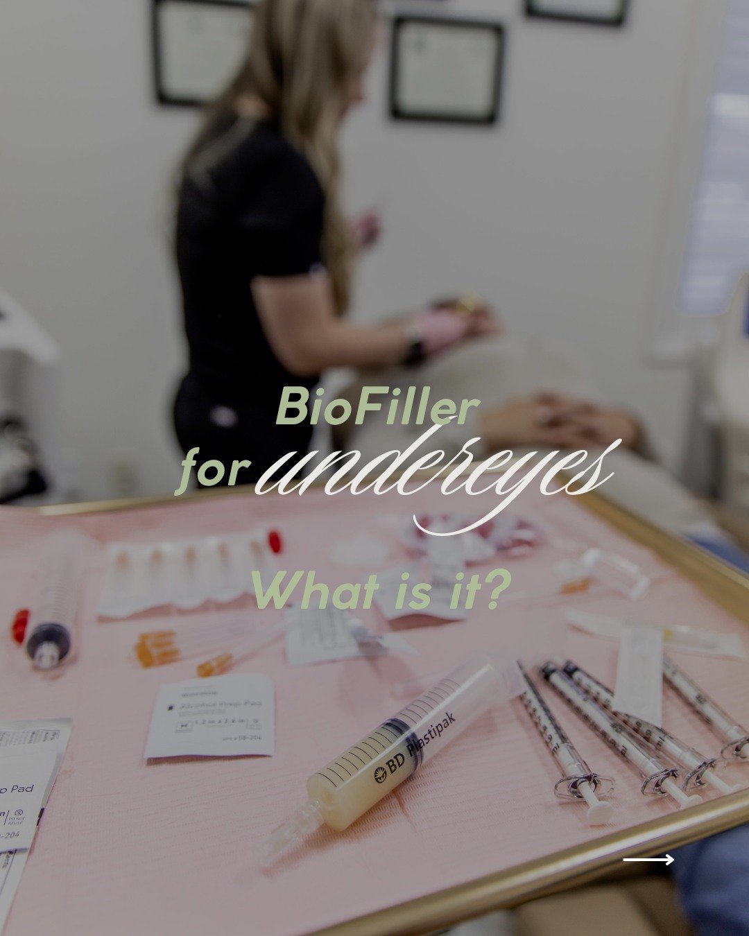 ✨Tired of dark circles and tired-looking eyes?✨
Our undereye biofiller gives you a refreshed, youthful look in just one session!💉💫 
Book your appointment today! Your glow-up is just a click away! 💖