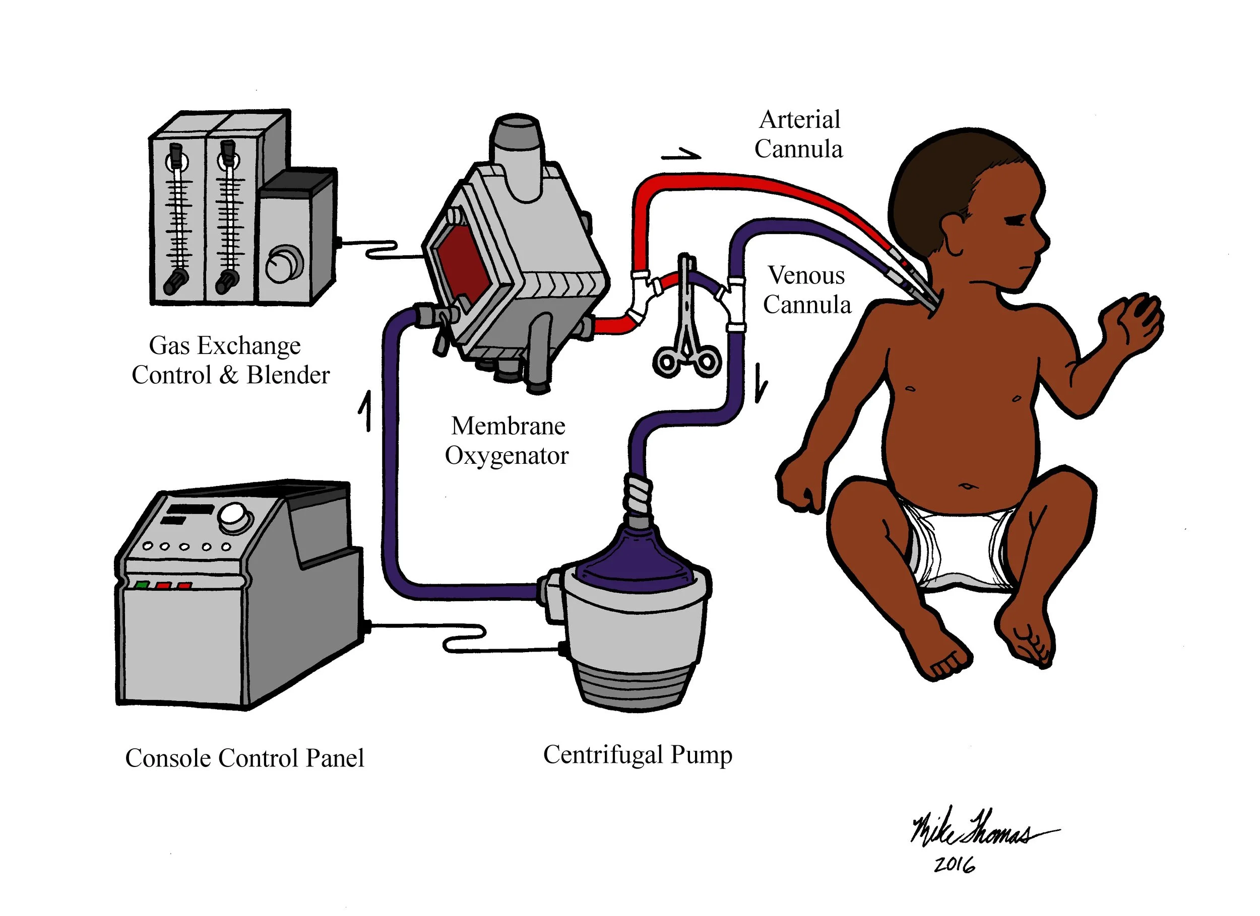"ECMO Machine"
Ink & Digital
2016