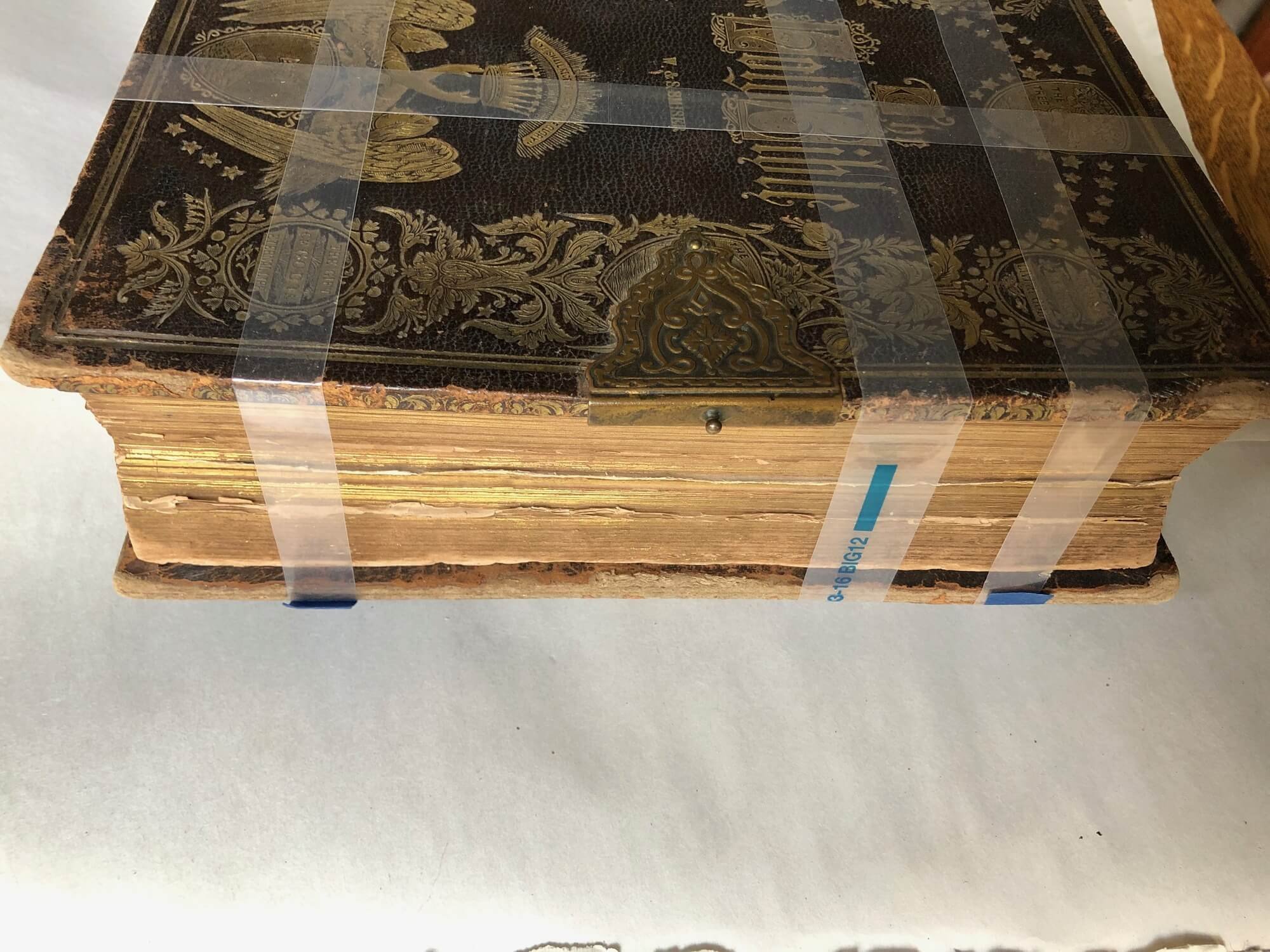  Before treatment, clasp missing 