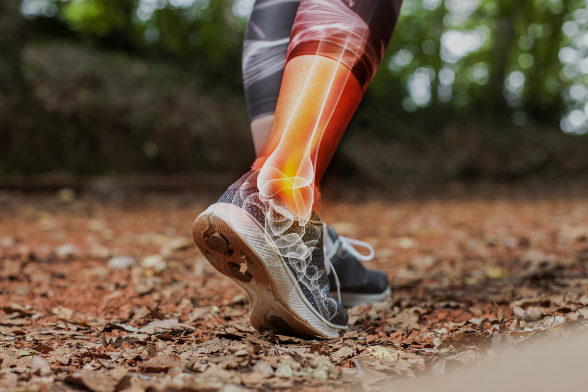 How to Stay Injury-Free as a Runner